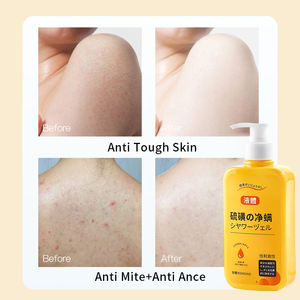 Jabón Líquido Antimite TWG, Gel de Baño Corporal, Jabón de Azufre <span class=keywords><strong>Acaricida</strong></span>, Gel de Ducha Antiacné - Product Image 5