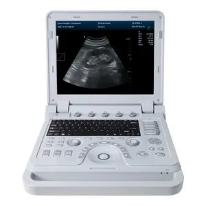 Contec Cms600p2plus Pseudo Kleur Doppler Echografie Machine <span class=keywords><strong>Ultrasone</strong></span> B <span class=keywords><strong>Ultrasone</strong></span> Doppler - Product Image 2