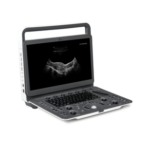 Échographe portable SonoScape E1 Exp avec Doppler couleur pour l'examen de l'abdomen, obstétrique/gynécologie, petites parties et vasculaire - Product Image 3