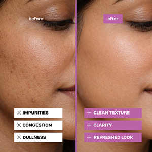 Fabricant et fournisseur de savon purifiant au charbon de sel de l'Himalaya naturel, marque privée, soins de la peau en gros - Product Image 4