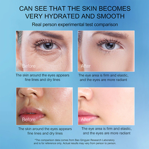 Cuidado DE LA PIEL personalizado, kits de cuidado de la piel facial de <span class=keywords><strong>rutina</strong></span>, hidratante Natural, brillo, ácido hialurónico, suero facial, conjunto de cuidado de la piel - Product Image 6