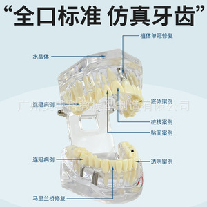 Modelos dentales, modelos de patología dental transparentes naturales, modelos de patología dental y modelos médico-paciente. - Product Image 2