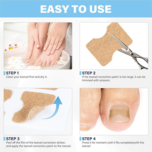 Patch de Correction des Ongles des Pieds, pour Ongles Incarnés et Rainurés, Favorise la Croissance Saine des Ongles, Prévient l'Incarnement, Boîte de Kit de Pédicure Non-tissée - Product Image 3