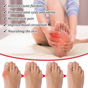 Herbal <b>Extract</b> Rose <b>Extract</b> Vitamin Fast Results Joint Pain Relief Bunion Cream for Toe & Foot Care in Bottle - Product Image 3