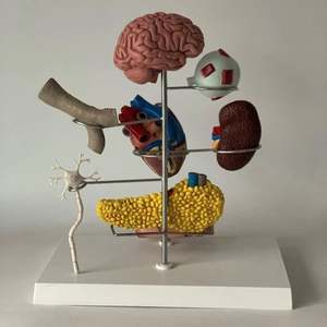 Modèle de maladies secondaires du diabète KyrenMed Modèle d'organe humain Modèle de diabète pathologique comprenant 8 parties Ensemble de diabète de type 2 - Product Image 2