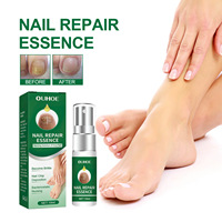 Sérum de traitement fongique des ongles OEM sérum de soin liquide pour la réparation des pieds gel blanchissant pour l'élimination des champignons des ongles des orteils 10ML