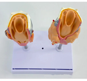 Modelo Anatómico de Tiroides Patológico Humano, Hipertiroidismo, Hipotiroidismo, Sistema Endocrino, Anatomía Médica, Tiroides, Garganta - Product Image 2