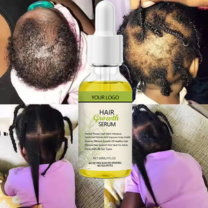 Aceite para el Crecimiento del Cabello <span class=keywords><strong>de</strong></span> Romero y Ricino 100% Natural <span class=keywords><strong>de</strong></span> Marca Privada al por Mayor, Suero Anticaída y Fortalecedor para el Cuidado del Cuero Cabelludo - Product Image 1