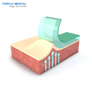 Ruban adhésif en silicone pour pansement imperméable à bas prix utilisé comme pansement secondaire ou pour protéger la peau douce - Product Image 5