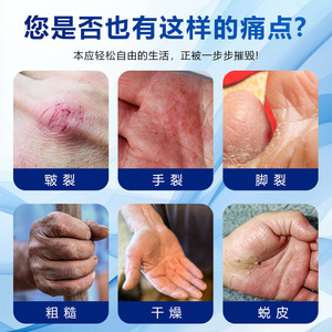 Crème pour les mains et les pieds ZhuHaxia 30g hydratante pour les soins des peaux sèches - Product Image 5