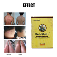 Salep Perawatan Kulit Herbal Caoshifu 10g untuk Dermatitis Eksim Krim Anti Gatal Urtikaria Desquamasi Formula Alami Balm