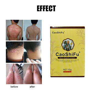 Caoshifu ครีมบำรุงผิวสมุนไพร10กรัมสำหรับโรคผิวหนัง, ครีมแก้คันลมพิษจากธรรมชาติ - Product Image 3