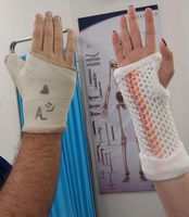 Manchon de plâtre en polymère pour rééducation orthopédique post-chirurgie – Fournitures de thérapie pour fractures