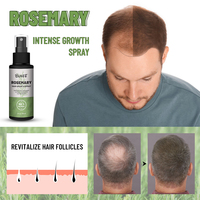 Minyak Serum Perawatan Rambut Rosemary Penumbuh Rambut Langsung dari Pabrik, Efek Terbaik, Semprotan Penumbuh Rambut 60ml