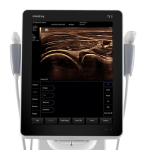 Appareil d'échographie mobile vétérinaire Mindray TE5 VET, système d'imagerie diagnostique ultrasonore numérique pour animaux - Product Image 4