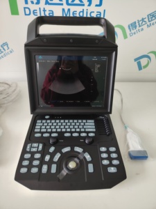 Zoncare M5, échographe portable le plus vendu, système d'imagerie diagnostique DMU24 3D 4D avec un excellent service après-vente - Product Image 4