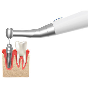 Nouveauté Produit dentaire Moteur X Clé dynamométrique intelligente pour implants / Clé dynamométrique électrique sans fil avec 16 tournevis - Product Image 6