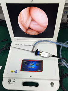 Медицинский аппарат 4 в 1, портативный эндоскопический блок, система камеры для назальной эндоскопии - Product Image 5