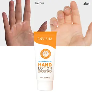 Forte efficace lozione antitraspirante per le mani antitraspirante Anti sudore ascellare crema per le mani per Hyperhidrosis