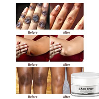Crème Lotion Visage Éclaircissante et Hydratante Correctrice Anti-Taches Brunes et Répératrice pour Peaux Noires