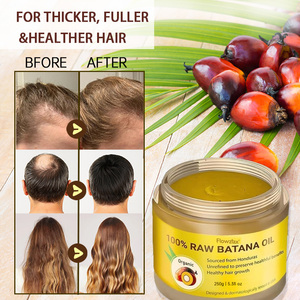 Aceite de Batana 100% Sin Refinar, Previene la Caída del Cabello, Fortalece el <span class=keywords><strong>Cuero</strong></span> <span class=keywords><strong>Cabelludo</strong></span>, Fortalece el Cabello, Lo Hace Más Largo, Anti-Enredos, para Cabello Rizado y Seco, Uso Doméstico, Fácil Absorción - Product Image 2