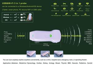 Mesin <span class=keywords><strong>Ultrasound</strong></span> Scanner Mode B untuk Rumah Sakit <span class=keywords><strong>Ipad</strong></span> <span class=keywords><strong>Ultrasound</strong></span> <span class=keywords><strong>Probe</strong></span> - Product Image 3