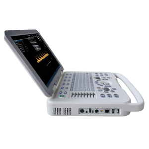 Sistema Ecografico Veterinario Digitale Completo SONOIMAGE D20 per Addome, <span class=keywords><strong>Ostetricia</strong></span>, Ginecologia, Parti Piccole ed Esami Vascolari con Certificazione CE - Product Image 1