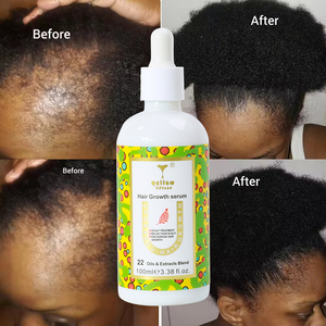 Kustom Rosemary Serum Minyak penumbuh rambut Ginseng Chebe kualitas tinggi Label pribadi untuk pertumbuhan rambut rambut Afrika Moq rendah pria - Product Image 1
