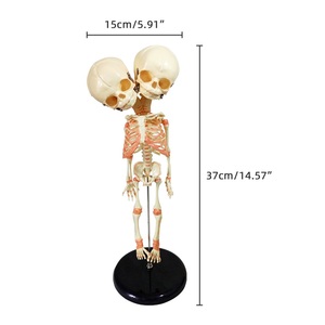 Foetale Twee Koppige Misvorming Model Schedel Medische Wetenschap Baby Skeletmodel Leert Menselijk Botmodel Abnormaal - Product Image 2
