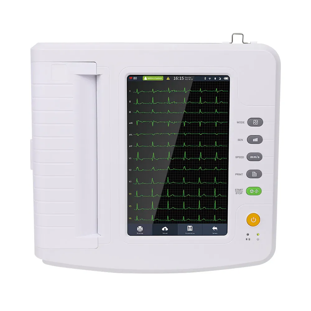 CONTEC ECG1212G 12 kurşun ekg 12 kanal elektrokardiyograf