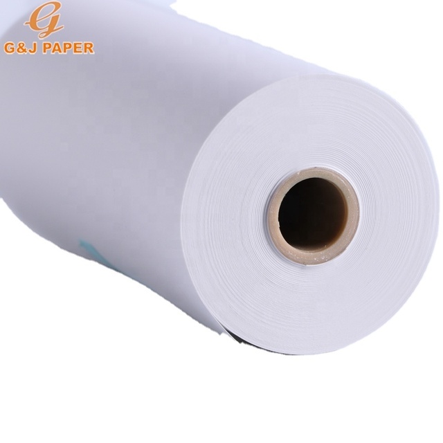 UPP-110hg Ultrasound Thermal Paper