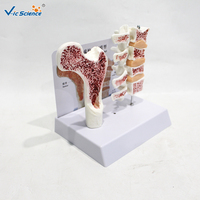 Modelo Anatómico de Patología de Densidad Ósea, Ayuda de Demostración Científica Popular sobre Osteoporosis, CE/ISO/ROHS/CNAS
