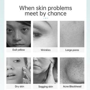 Máquina Facial de Hidrógeno y Oxígeno 9 en 1, Venta Caliente 2026, Hidratación de la Piel, Blanqueamiento, Limpieza de Poros, Dermoabrasión con Agua - Product Image 5