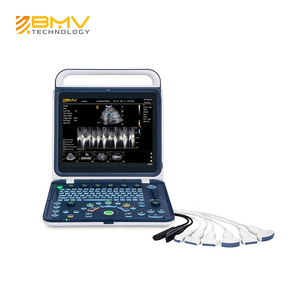 Doppler-sistema de ultrasonido a Color, máquina de ultrasonido GYN portátil, con carrito, instrumentos de ultrasonido médico - Product Image 5