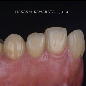 PFZ BAOT impiallacciature per denti naturali protesi Dental Lab investimento materiale dentale in ceramica trasparente T-2 50g - Product Image 5