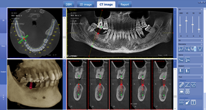2026 नवीनतम cbct डेंटल एक्स रे मशीन उपकरण mssdald307 - Product Image 5