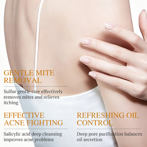 Savon au soufre KORMESIC pour l'élimination des acariens, marque privée OEM, 100g, savon de bain naturel, barre de savon à mousse riche, nettoyage doux, blanchissant, éclaircissant - Product Image 2