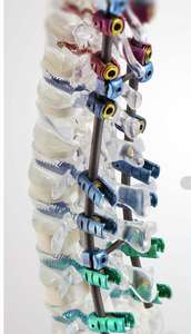 Sekrup Semen Tulang Berkualitas Tinggi dan Harga Kompetitif dengan Berbagai Tipe - Product Image 3