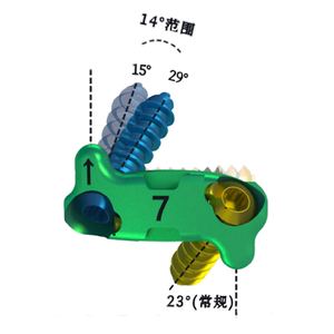 Orthopedische Chirurgische Implantaten <span class=keywords><strong>Titanium</strong></span> Fedex Aangepast Nulprofiel Anterieure Cervicale Kooi Instrumenten Klasse Iii Ce Gecertificeerd - Product Image 4