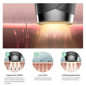 Nouveauté : Épilateur efficace pour usage domestique avec plusieurs modes – Éliminez les poils sans effort - Product Image 2