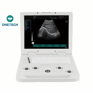 Échographe vétérinaire portable B17 numérique pour diagnostic humain/vétérinaire avec mode couleur - Product Image 2