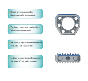 Rangka Fusi <span class=keywords><strong>Interbody</strong></span> Serviks, Berbentuk Wedge & Bentuk Busur - Product Image 5