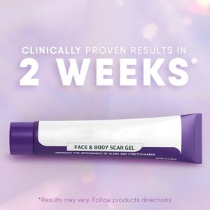 เจลลดรอย<span class=keywords><strong>แผล</strong></span><span class=keywords><strong>เป็น</strong></span>บนใบหน้าและร่างกาย ครีมซ่อมแซมรอย<span class=keywords><strong>แผล</strong></span><span class=keywords><strong>เป็น</strong></span>จากการผ่าตัด รอยแผล<span class=keywords><strong>เป็น</strong></span>เก่าและใหม่ รอยแตกลาย <span class=keywords><strong>แผล</strong></span>จากการผ่าตัด <span class=keywords><strong>แผล</strong></span>จากการบาดเจ็บ <span class=keywords><strong>แผล</strong></span>ไฟไหม้ สิว - Product Image 5