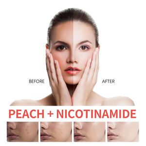 Suero Facial Exfoliante Blanqueador con Nicotinamida y Aloe Vera Hidratante de Marca Privada OEM - Product Image 4