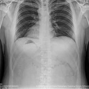 Độ Phân Giải Cao 17*17 Không Dây Phẳng <span class=keywords><strong>Detector</strong></span> DR Hệ Thống Chẩn Đoán Cho Con Người Thú Y Sử Dụng Điện Của Nhãn Hiệu Thép Kim Loại - Product Image 3