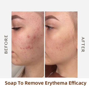 <span class=keywords><strong>Savon</strong></span> Corporel Rectangulaire au Curcuma Bio Naturel, Meilleure Vente en Gros, Élimine les Peaux Mortes, Blanchit les Peaux Grasses, Formule Végétale - Product Image 6