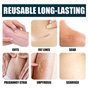 Jaysuing 50ml Crema China para Eliminar Cicatrices, Reduce Líneas de Expresión, Estrías del Embarazo, Tratamiento Avanzado para Cicatrices, Gel para Cicatrices - Product Image 6