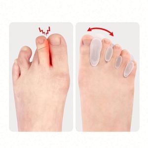 Corrector de Dedos del Pie en Gel de Silicona, Portátil y Cómodo, para Dedos Encurvados, Ajuste de Juanetes, Herramienta para el Cuidado de los Pies - Product Image 5