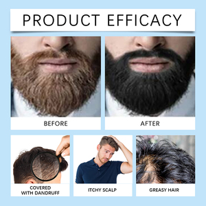 Hữu cơ chất lượng cao nam râu chăm sóc đồng phục màu giữ ẩm Râu Đen râu dầu gội đầu cho nam giới - Product Image 6