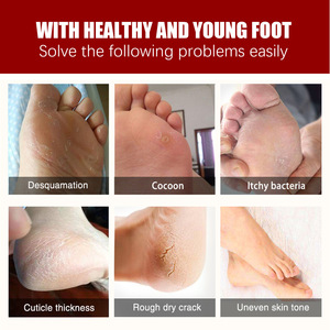 Solución Exfoliante de Alta Calidad con 30% AHA y 2% BHA para Diversos Problemas de Pies, Mascarilla para el Cuidado de los Pies - Product Image 6